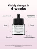 COSRX Niacinamide 15 Serum benefits chart showing improvements in oil control, blackheads/whiteheads, acne, pores, blemishes, and skin tone in 4 weeks