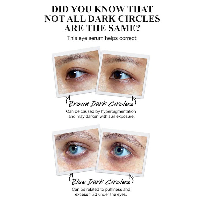 KIEHLS - Powerful-Strength Dark Circle Reducing Vitamin C Eye Serum - 15ML