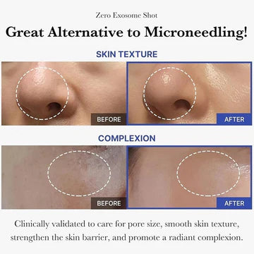 Before and after comparison of skin texture and complexion with text highlighting benefits.