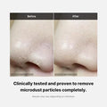 Before and after comparison of a nose with text indicating microdust removal.