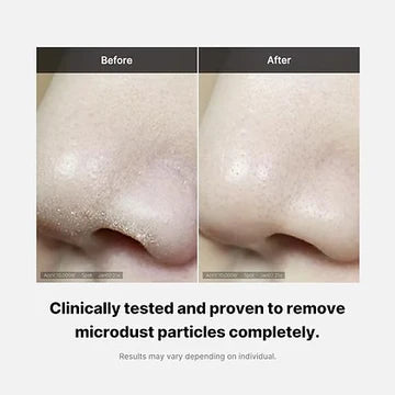 Before and after comparison of a nose with text indicating microdust removal.
