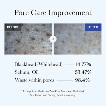 Before and after comparison of pore care improvement with text on blackhead, sebum, and waste within pores.