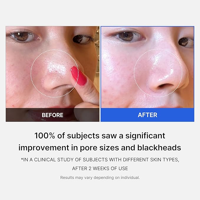 Buy Medicube Zero Pore Pad 2.0 (70pcs) in Pakistan