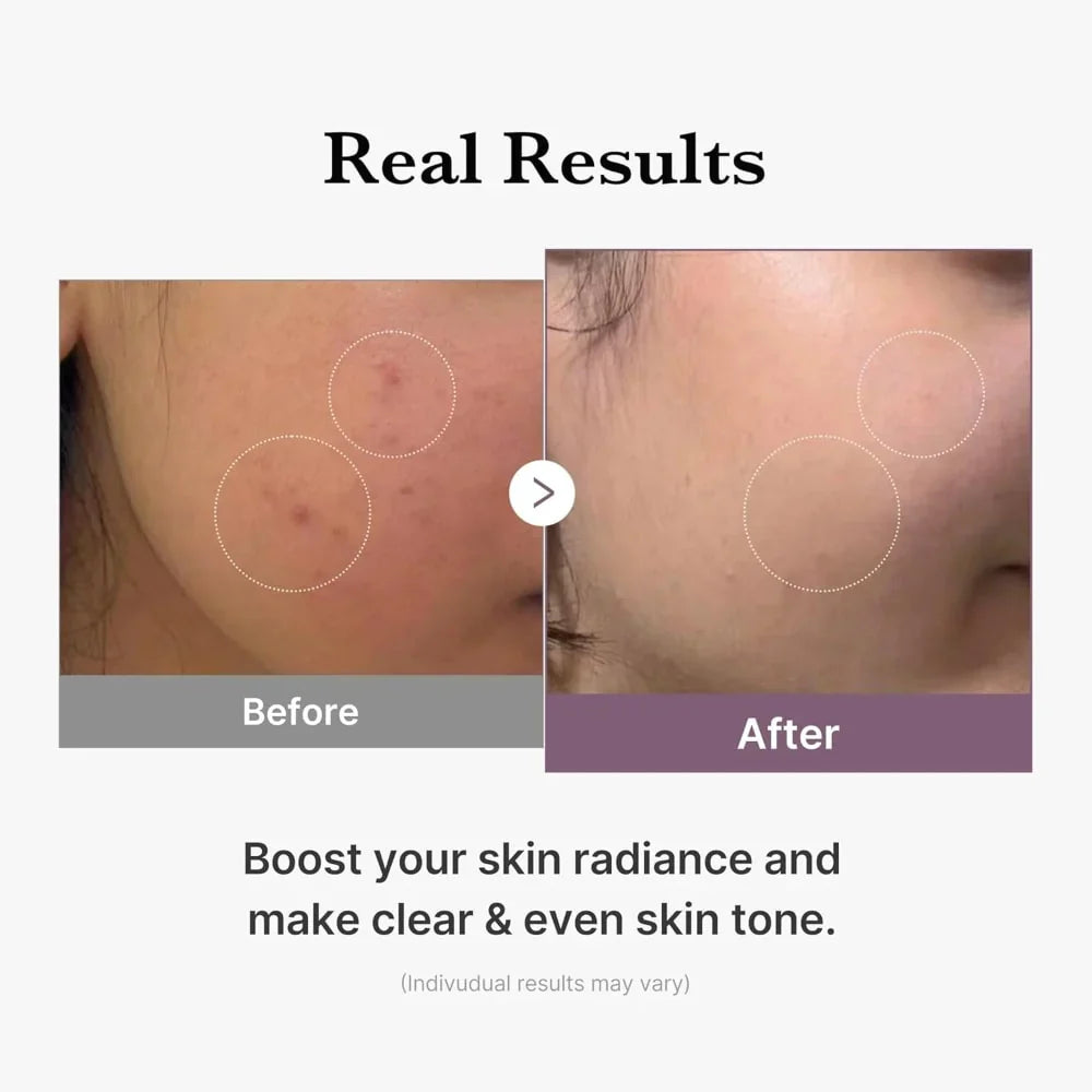 Buy Medicube AGE-R Glutathione Glow Milk Toner in Pakistan