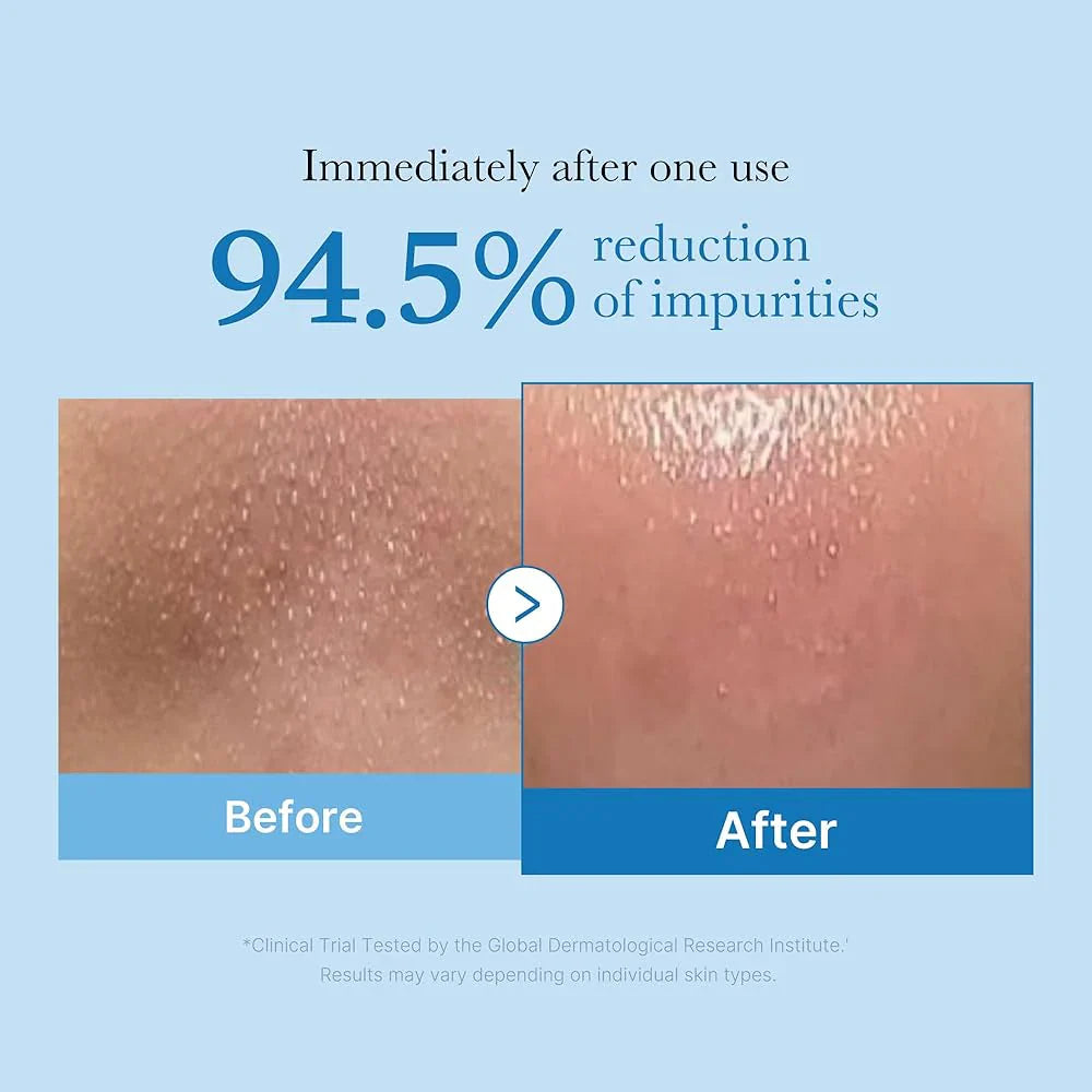 Buy Medicube Zero Pore Blackhead Deep Cleansing Oil in Pakistan