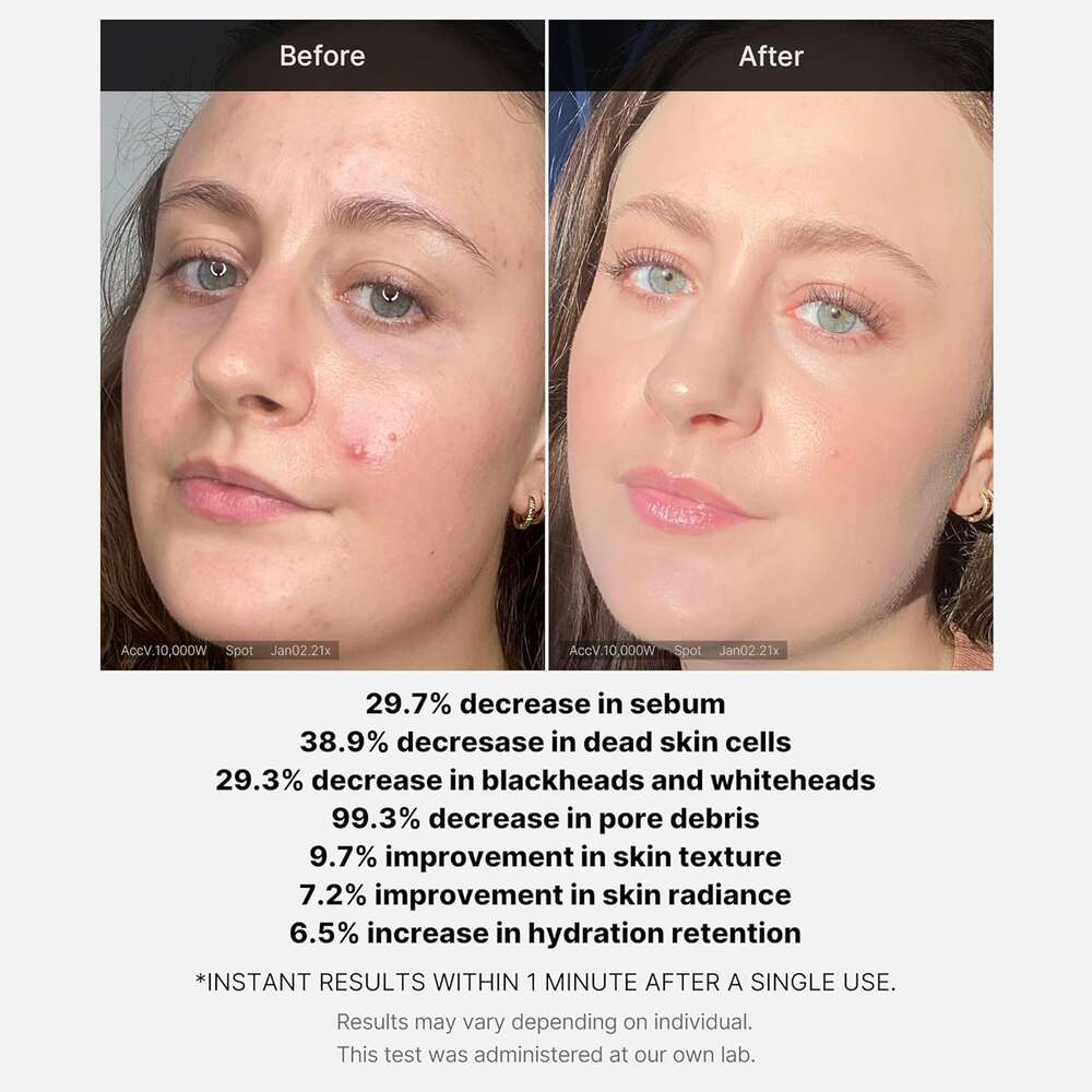 Buy Medicube Red Acne Succinic Acid Peel in Pakistan