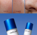 Buy Medicube Zero Pore Serum 2.0 in Pakistan