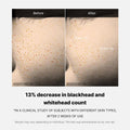 Buy Medicube Zero Pore One Day Serum in Pakistan