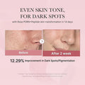 Before and after skin transformation with dark spot reduction on a pink background