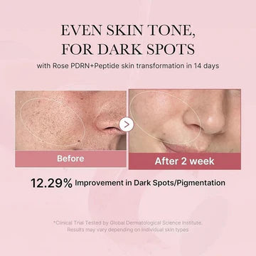 Before and after skin transformation with dark spot reduction on a pink background
