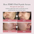 Advertisement for Rose PDRN Pink Peptide Serum showing before and after effects on skin.