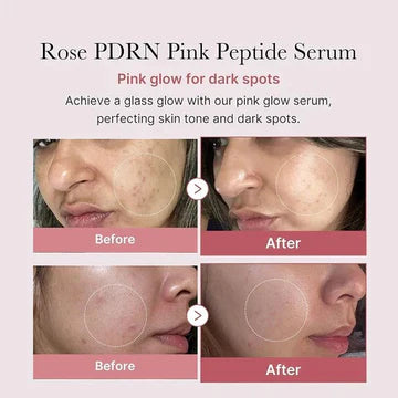 Advertisement for Rose PDRN Pink Peptide Serum showing before and after effects on skin.