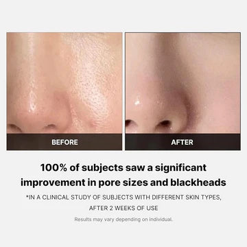 Before and after comparison of skin with pore sizes and blackheads, showing a clinical study result.