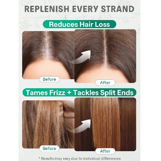 SHEGLAM - HAIR Red Onion Hair And Scalp Oil Clear - 15ml