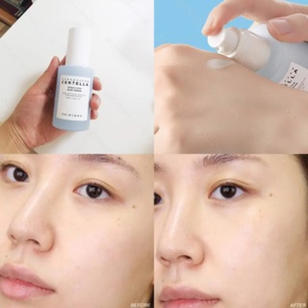 Before and after comparison of a skincare product application on a person's face.